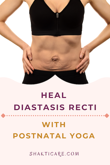 woman's belly with diastasis recti